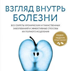 Взгляд внутрь болезни. Все секреты хронических и таинственных заболеваний и эффективные способы их полного исцеления. Обновленное и дополненное издание