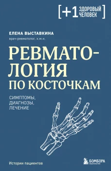Ревматология по косточкам. Симптомы диагнозы лечение