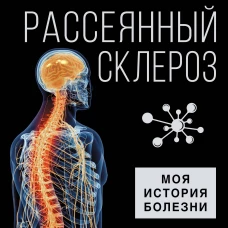 Рассеянный склероз. Моя история болезни