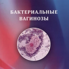 Бактериальные вагинозы. Климов Н.А., Шамова О.В.