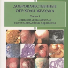 Доброкачественные опухоли желудка ч.1 Эпителиальные опухоли и опухолеподобные поражения