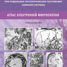 Ультраструктура нервной ткани при отдельных патологических состояниях нервной системы. Атлас электронной микроскопии: Учебное пособие