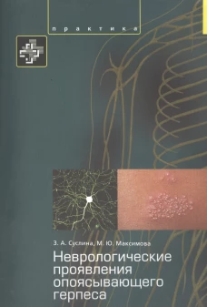 Неврологические проявления опоясывающего герпеса. Пособие для врачей