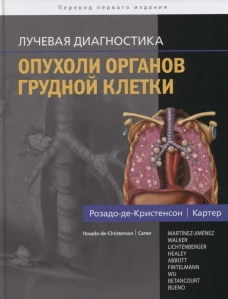 Лучевая диагностика. Опухоли органов грудной клетки. Розадо-де-Кристенсон М.Л., Картер Б.В