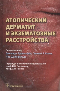Атопический дерматит и экзематозные расстройства. Под ред. Рудикоффа Д.