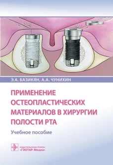 Применение остеопластических материалов в хирургии полости рта: Учебное пособие. Базикян Э.А., Чунихин А.А