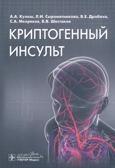 Криптогенный инсульт: руководство. Сыромятникова Л. И., Кулеш А.А., Дробаха В.Е.