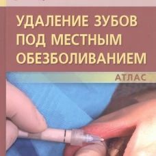 "Удаление зубов под местным обезболиванием. Атлас. Сохов С.Т., Афанасьев В.В., Абдусаламов М.Р.