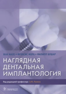 Наглядная дентальная имплантология. Мале Ж., Мора Ф., Бушар Ф.