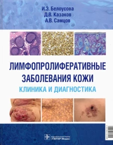 Лимфопролиферативные заболевания кожи. Клиника и диагностика. Белоусова И.Э., Самцов А.В., Казаков Д.В.