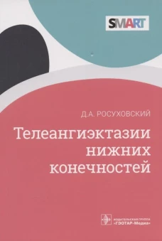 Телеангиэктазии нижних конечностей. Росуховский Д.А.