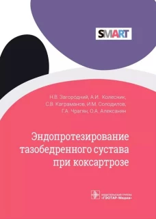 Эндопротезирование тазобедренного сустава при коксартрозе. Загородний Н.В., Колесник А.И., Каграманов С.В.