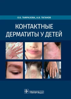 Ольга Тамразова: Контактные дерматиты у детей