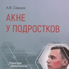 Акне у подростков. Самцов А.В.