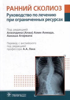 Ранний сколиоз. Руководство по лечению при ограниченных ресурсах. Под ред. Ахмада А.А., Агарвала А.