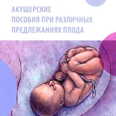 Акушерские пособия при различных предлежаниях плода: Учебное пособие. Василенко Л.В., Новиков Е.И., Каплун И.Б.