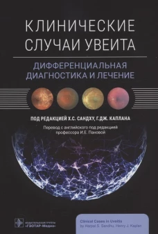 Клинические случаи увеита. Дифференциальная диагностика и лечение. Под ред. Сандху Х.С.