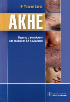 Акне. Дэнби У.Ф.