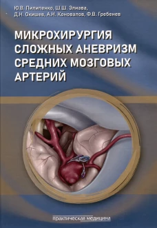 Микрохирургия сложных аневризм средних мозговых артерий: гигантских, фузиформных и частично тромбированных