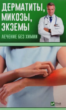 Дерматиты, микозы, экземы. Лечим без химии