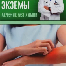Дерматиты, микозы, экземы. Лечим без химии