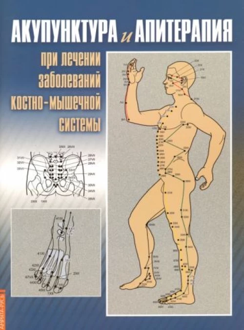 Акупунктура и апиратерапия