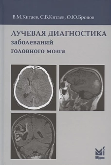 Лучевая диагностика заболеваний головного мозга. 3-е изд. Китаев В.М., Китаев С.В., Бронов О.Ю.
