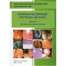 Доброкачественные опухоли желудка. Неэпителиальные опухоли. Ч. 2: Учебно-методическое пособие. Кузин М.Н., Добронец В.В., Шкалова Л.В.