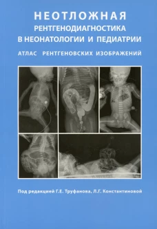 Неотложная рентгенодиагностика в неонатологии и педиатрии (Атлас рентгеновских изображений). Руководство для врачей. Под ред. Труфанова Г.Е., Константиновой Л.Г.