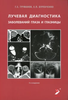 Лучевая диагностика заболеваний глаза и глазницы. 3-е изд. Труфанов Г.Е., Бурлаченко Е.П.