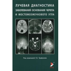 Лучевая диагностика заболеваний оснований черепа и мостмозжечкового угла: Учебное пособие. Под ред. Труфанова Г.Е.