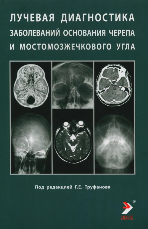 Лучевая диагностика заболеваний оснований черепа и мостмозжечкового угла: Учебное пособие. Под ред. Труфанова Г.Е.