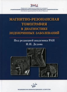 Магнитно-резонансная томография в диагностике эндокринных заболеваний. Воронцов А.В., Владимирова В.П., Бабаева Д.М.