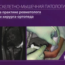 Скелетно-мышечная патология в практике ревматолога и хирурга-ортопеда: Краткое иллюстрированное руководство. Каратеев А.Е., Макаров М.А., Макаров С.А.