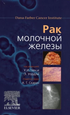 Рак молочной железы. Под ред. Чен У.И., Уордли Э.