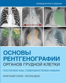 Основы рентгенографии органов грудной клетки. Кларк К., Дюкс Э.