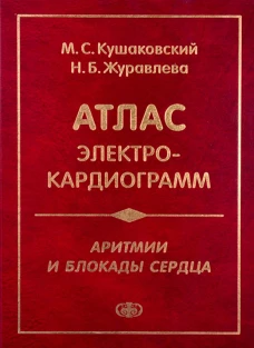 Аритмии и блокады сердца: атлас электрокардиограмм. 5-е изд., перераб. и доп. Журавлева Н.Б., Кушаковский М.С.