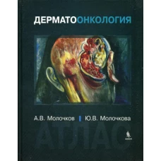 Дерматоонкология. Атлас. Молочков А.В., Молочкова Ю.В.