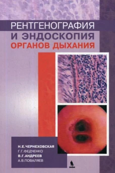 Рентгенография и эндоскопия органов дыхания: Учебное пособие. Чернеховская Н.Е., Андреев В.Г., Федченко Г.Г.