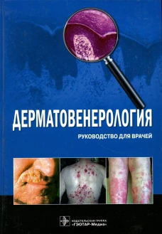 Дерматовенерология. Руководство для врачей. Бутов Ю.С., Потекаев Н.Н.