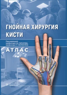 Гнойная хирургия кисти. Атлас. Под ред. Липатова К.В., Мелконяна Г.Г.