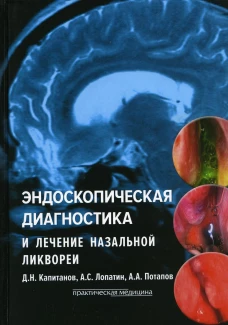 Эндоскопическая диагностика и лечение назальной ликвореи. Потапов А.А., Лопатин А.С., Капитанов Д.Н.