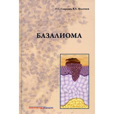 Базалиома. Молочков В.А., Снарская Е.С.