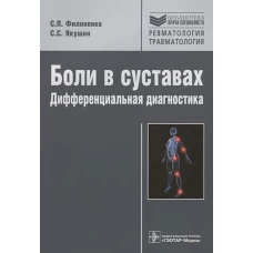 Боли в суставах. Дифференциальная диагностика