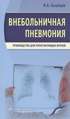 Внебольничная пневмония