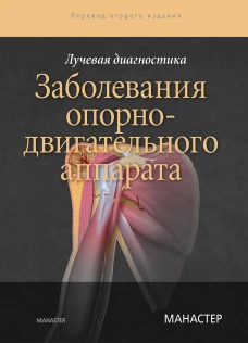Лучевая диагностика. Заболевания опорно-двигательного аппарата