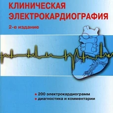 Клиническая электрокардиография. 2-е изд