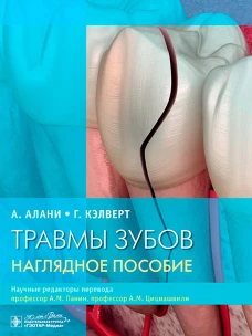 Травмы зубов.Наглядное пособие