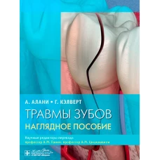 Травмы зубов.Наглядное пособие