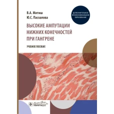 Высокие ампутации нижних конечностей при гангрене